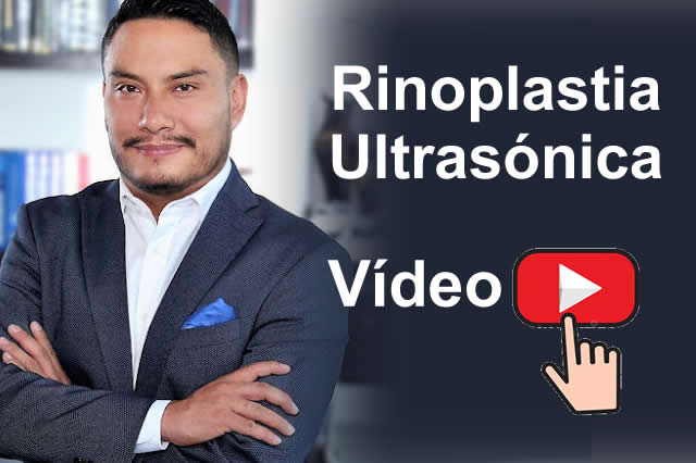 TESTIMONIOS RINOPLASTIA EN QUITO